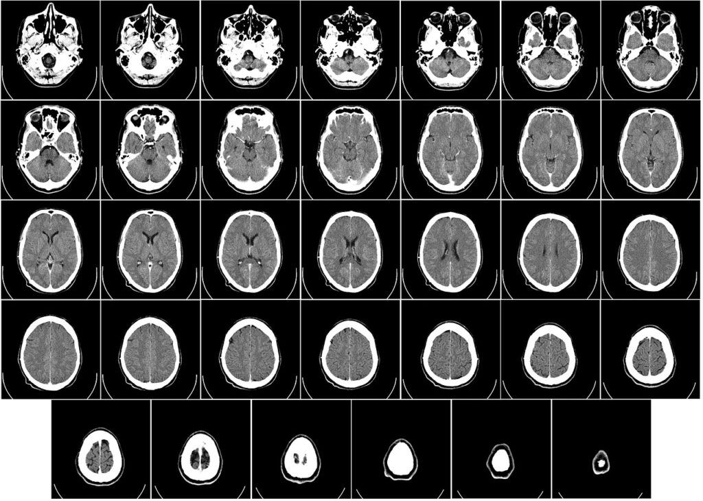 computer tomography, ct, radiography-62942.jpg