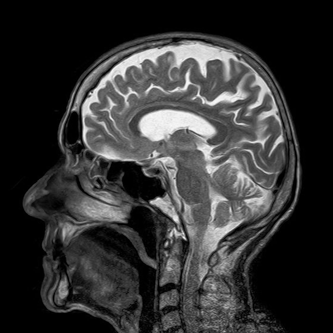 mri, magnetic resonance, roentgen-782459.jpg